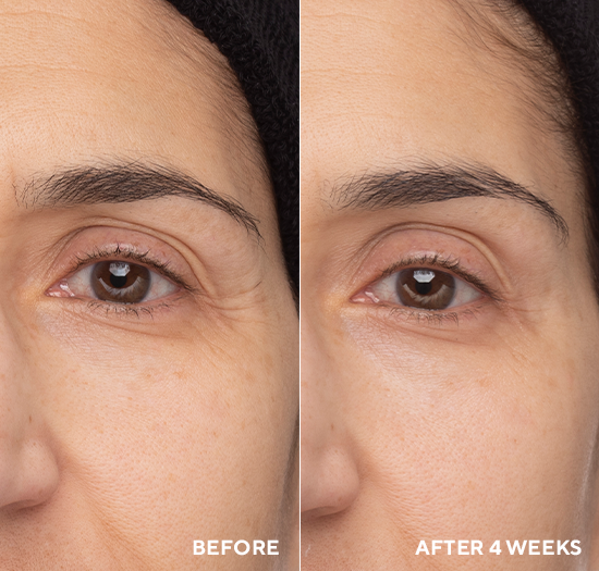 RETINOL EYE RENEWAL | Retinol | LOSHEN & CREM