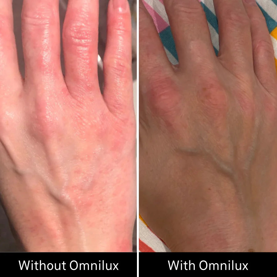 OMNILUX CONTOUR GLOVE | LED mask | LOSHEN & CREM