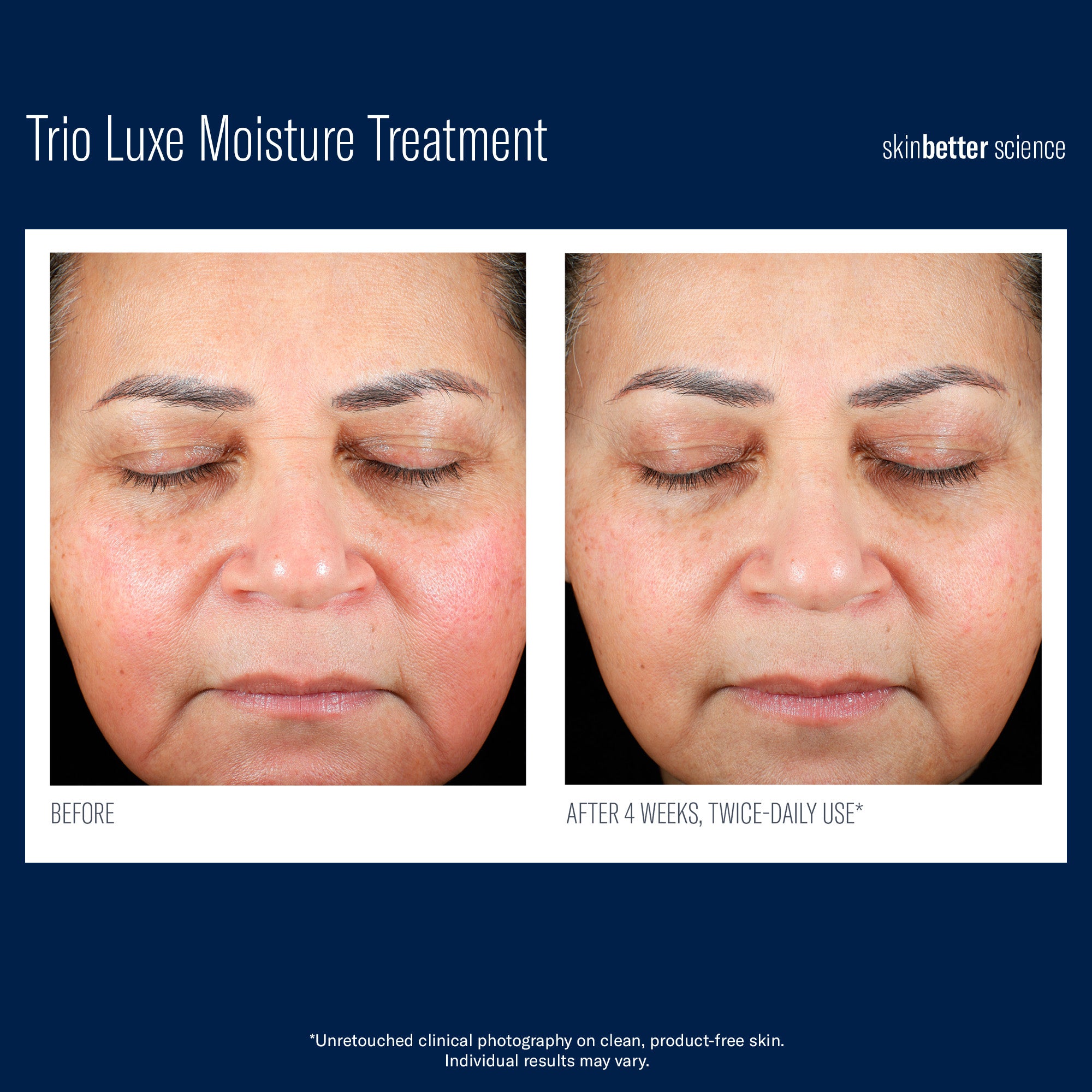 TRIO LUXE MOISTURE TREATMENT | Healthy aging cream | LOSHEN & CREM