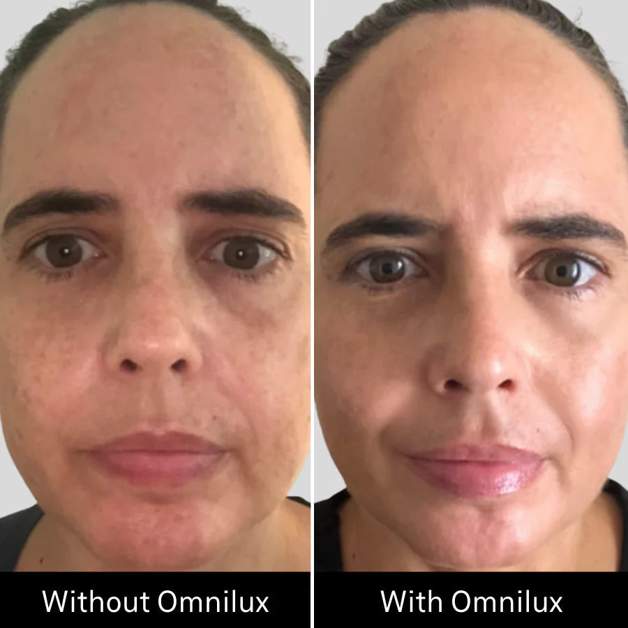 OMNILUX CONTOUR FACE | LED mask | LOSHEN & CREM