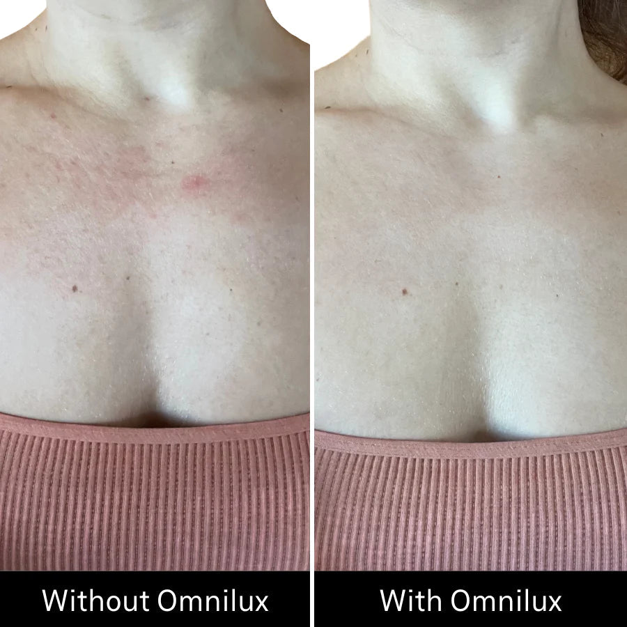 OMNILUX CONTOUR NECK & DECOLLETE | LED mask | LOSHEN & CREM