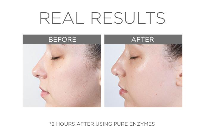 PURE ENZYMES | Enzymatic exfoliant | LOSHEN & CREM