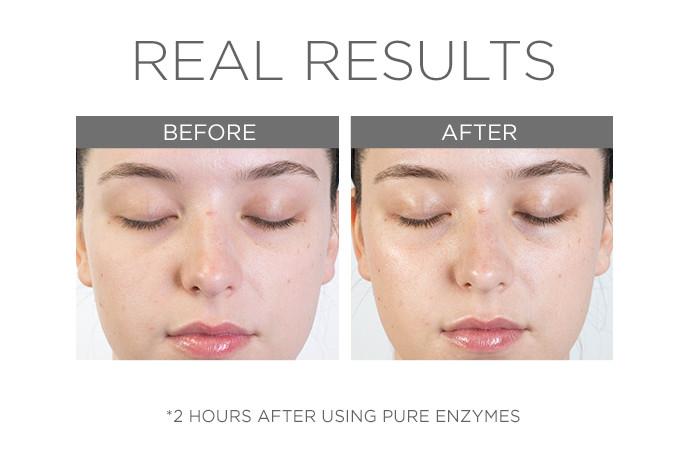 PURE ENZYMES | Enzymatic exfoliant | LOSHEN & CREM