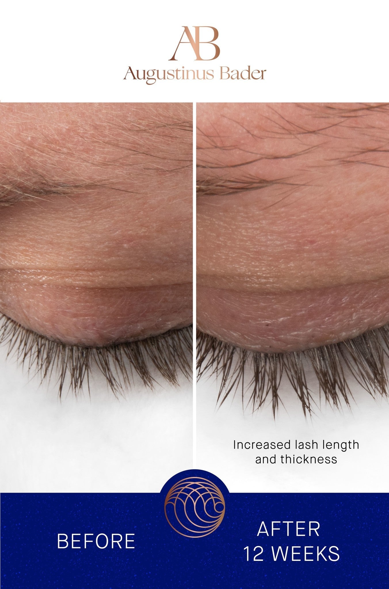 THE EYEBROW AND LASH ENHANCING SERUM | Lash & Brow growth treatment | LOSHEN & CREM