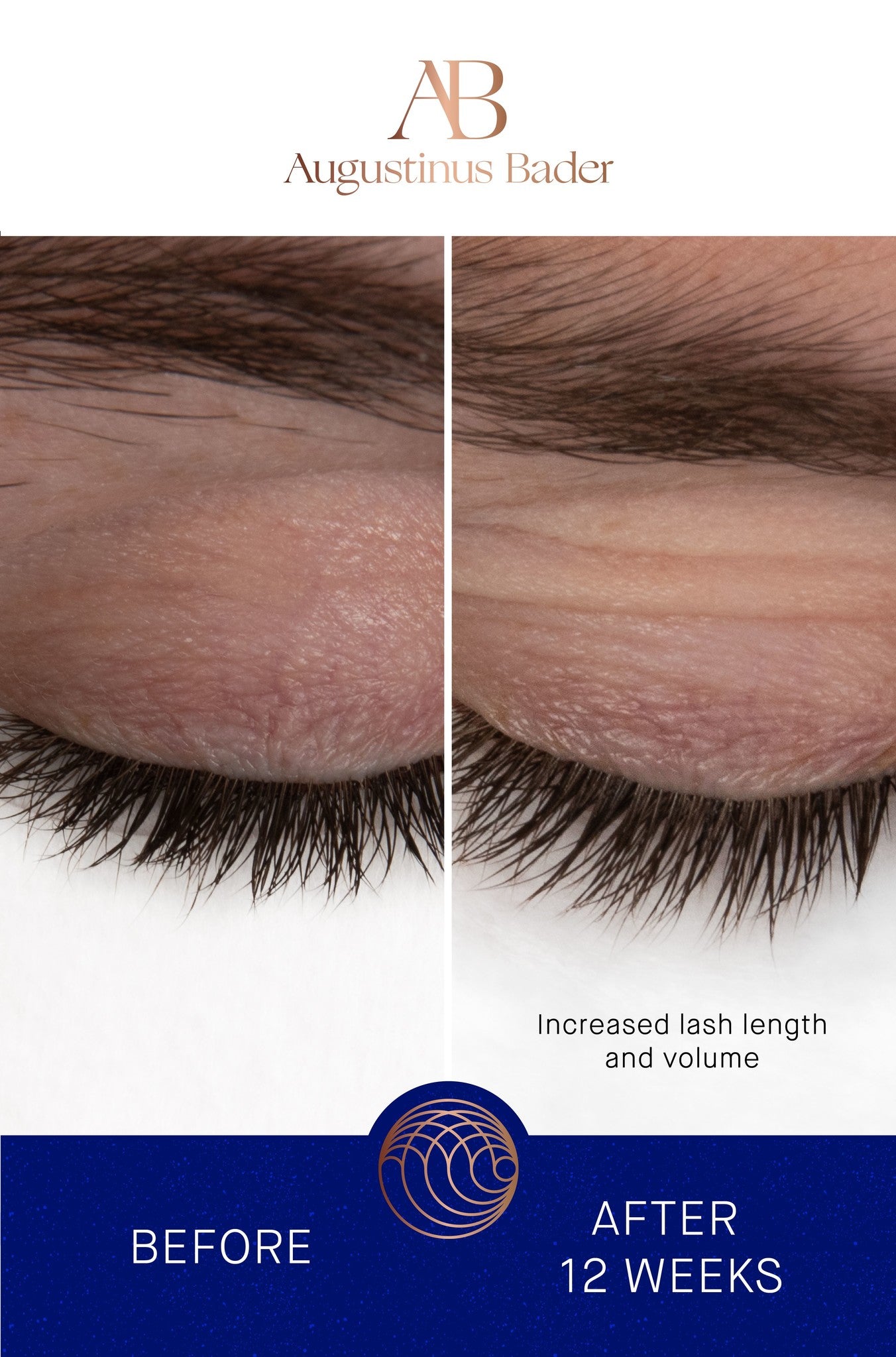 THE EYEBROW AND LASH ENHANCING SERUM | Lash & Brow growth treatment | LOSHEN & CREM